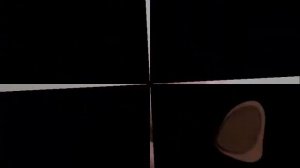 Как лечить Гигрому народными средствами в домашних условиях