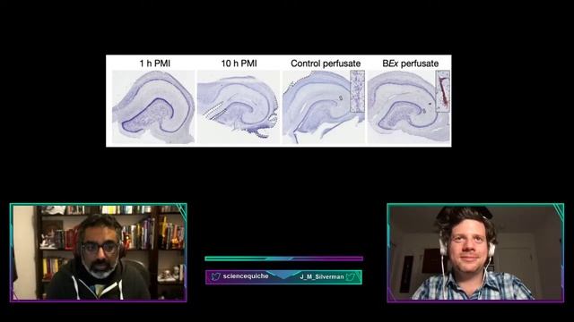 The Science Of Young Frankenstein