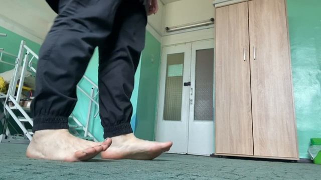 Plano-valgus deformity of the feets. Protruding bump. Hallux valgus смотреть онлайн