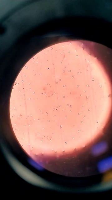 bacillus typical spores under Microscope #bacteria #bacillus #spores #microbes #classy смотреть онлайн