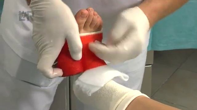Целлакаст - повязка на голеностоп смотреть онлайн