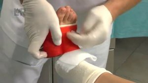 Целлакаст - повязка на голеностоп