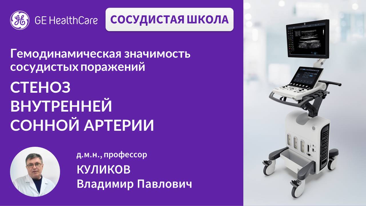 Сосудистая школа GE Healthcare. Стеноз внутренней сонной артерии. Сессия 09