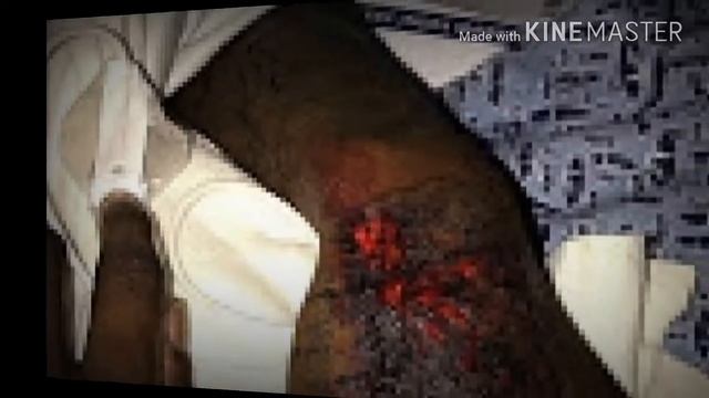 Offset sufre tremendo accidente y casi muere/suffers tremendous accident and almost died смотреть онлайн