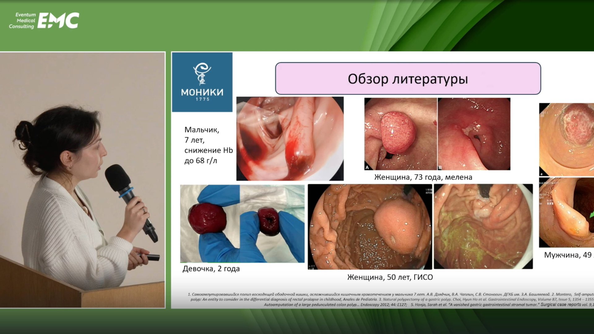 3. Елкина В.С., Вербовский А.Н. Диагностика и лечение кровотечения неясной этиологии у ребенка.