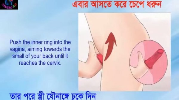 Female Condom Bangla । মেয়েদের কনডম। কিভাবে মেয়েরা কনডম ব্যবহার করে আসুন জেনে নেই ।