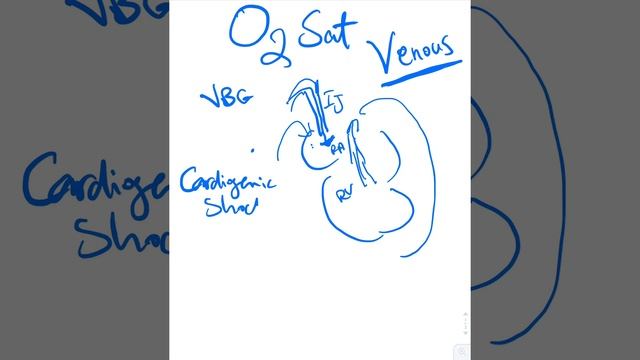 Central Venous Oxygen Saturation - Dr Jamal USMLE смотреть онлайн