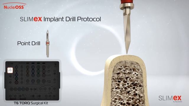 New SLIMEX - Surgical Procedure Video смотреть онлайн