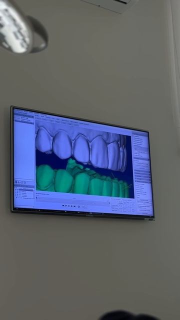 ОБУЧЕНИЕ ГНАТОЛОГИИ смотреть онлайн