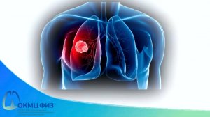 Ролик «ОКМЦ ФИЗ» - Профилактика туберкулеза