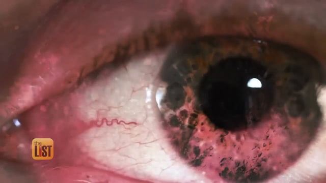 3 Tips to Improve Your Vision, According to an Optometrist смотреть онлайн