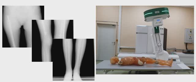 Сшивка. Сканирование смотреть онлайн