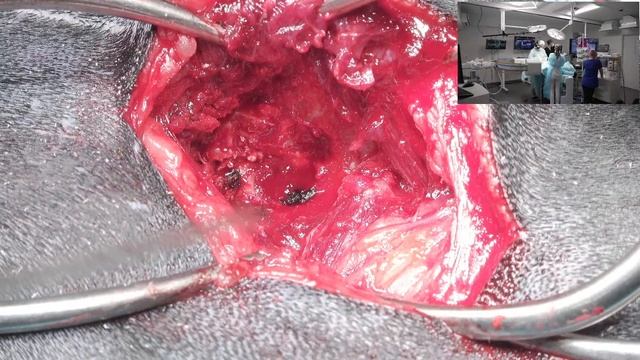 Собака болезнь дисков первый тип Гемиламинэктомия. смотреть онлайн