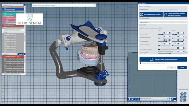 Helix Dental Digital Dentures La Mesa смотреть онлайн