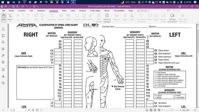 SCI Assessment | ASIA Scale | Spinal Cord Injury | Bangla | Physiotherapy | PKS Lectures