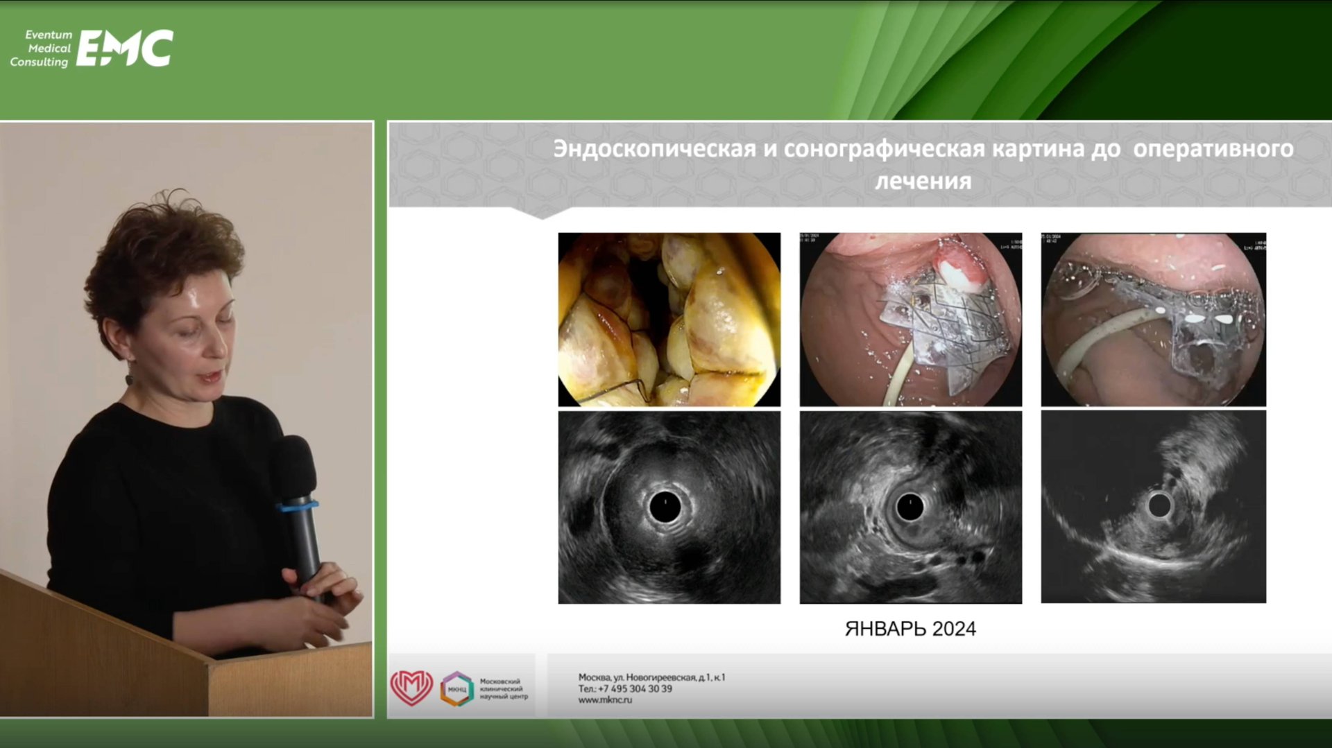 1. Индейкина Л.Х., Парфенчикова Е.В. IgG4-ассоциированный гастрит. Клиническое наблюдение.