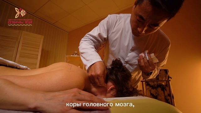 Игукалывание