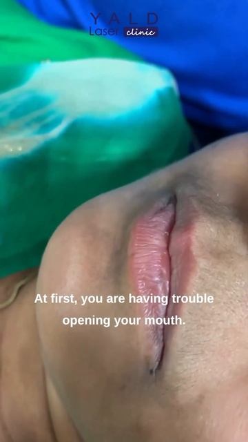 Light therapy for Pain Management | Yald Laser Clinic #lighttherapy #health смотреть онлайн