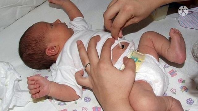 Yangi Tuģilgan Chaqaloq Kindigi Parvarishi|UZ BABY