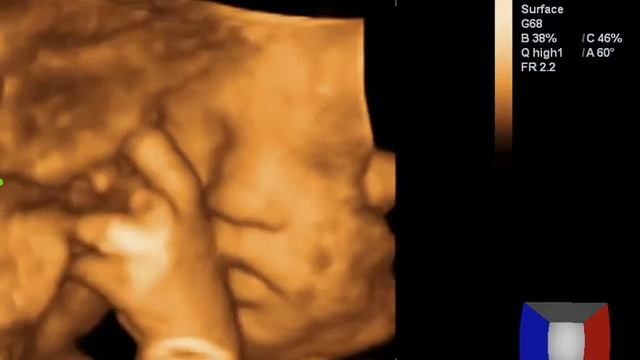 4D УЗИ в Новороссийске недорого: наблюдайте за малышом до рождения смотреть онлайн