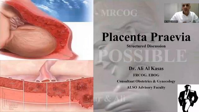 Placenta Praevia - SD Task - MRCOG Part 3 Mission Possible Course Guide Session Part 3 смотреть онлайн