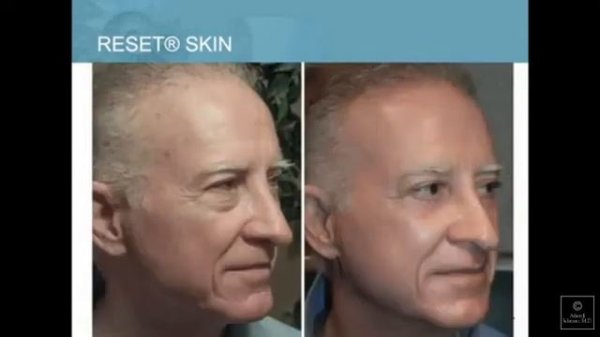 Доктор Шнайдер X39 вебинар