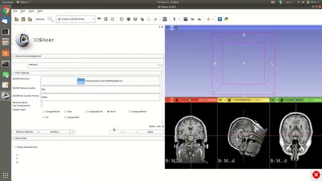 Slicer 2020 06 Creating DICOM Image using 3D Slicer смотреть онлайн