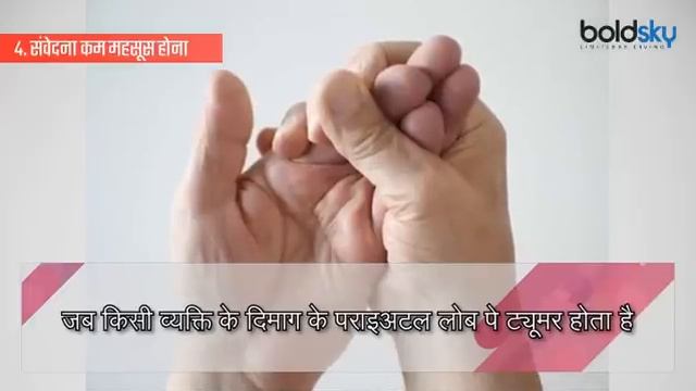 Brain Tumor Symptoms: Must not ignore | ब्रेन ट्यूमर के ये लक्षण कर देंगे हैरान | Boldsky смотреть онлайн