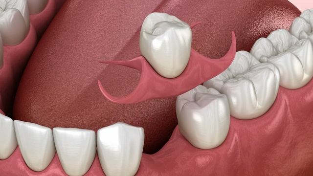 Протезирование зубов смотреть онлайн