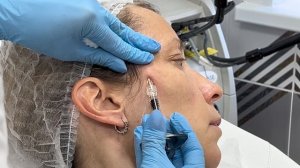 Super Idea, врач Елена Косенко Санкт-Петербург