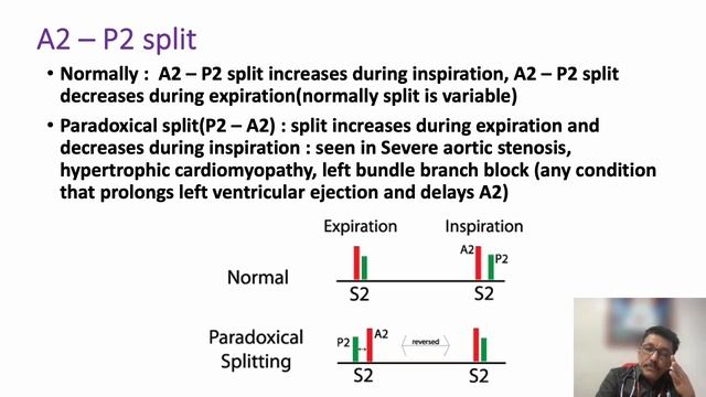 Aortic Stenosis смотреть онлайн