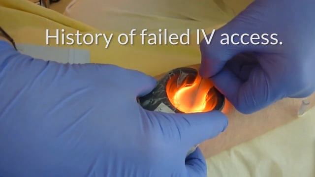 Finding Veins in Elderly Patient смотреть онлайн