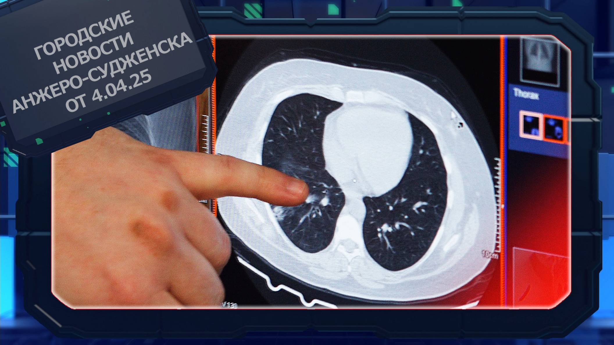 Городские новости Анжеро-Судженска от 04.04.25 смотреть онлайн