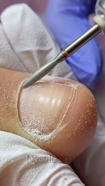 Кутикула / педикюр / фреза #nails #ногти #pedicure #pedicura #skincare #кутикула #фреза #педикюр смотреть онлайн
