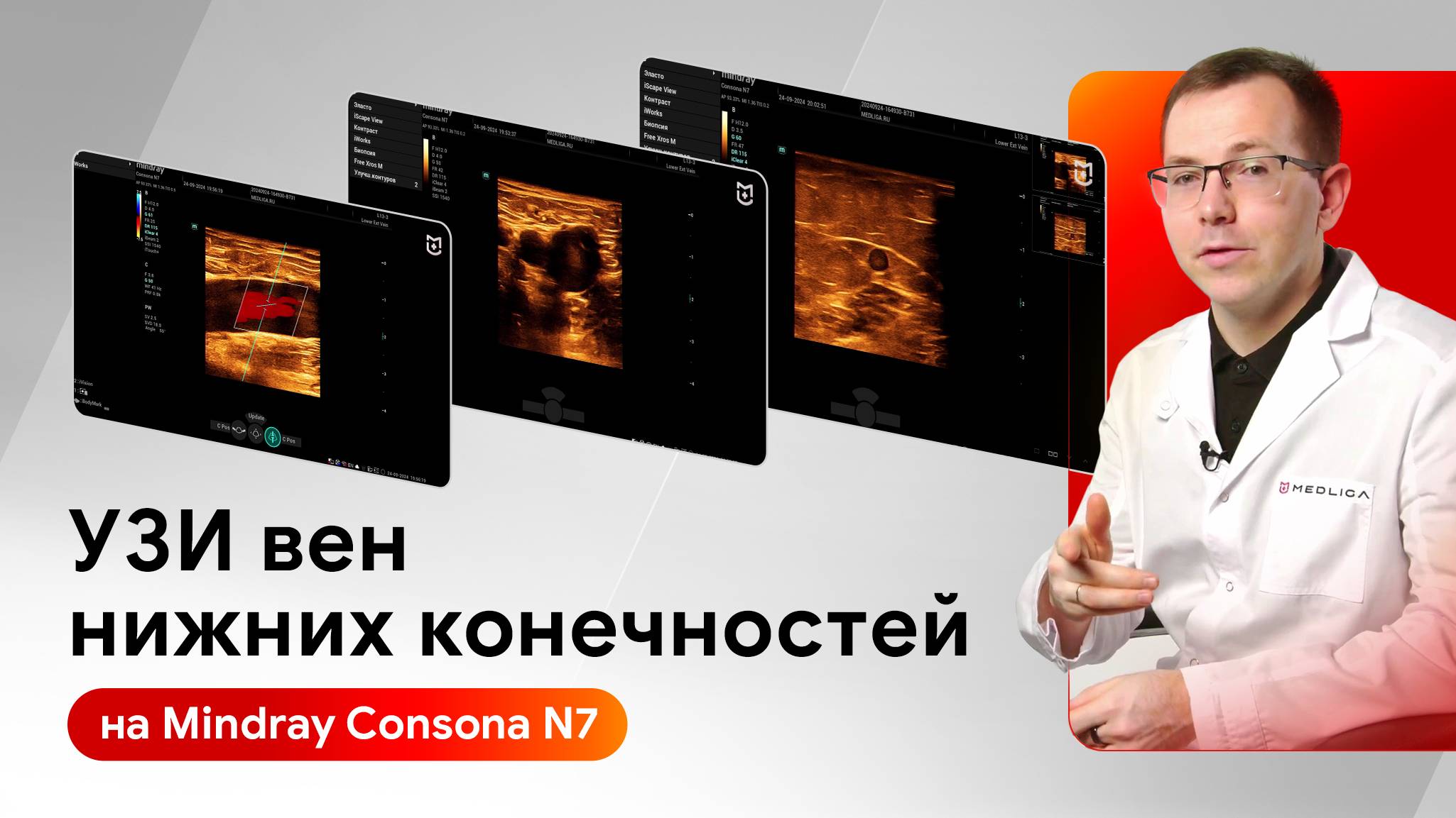Техника сканирования вен нижних конечностей на Mindray Consona N7