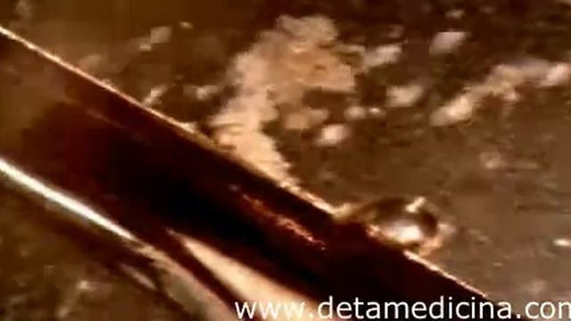 Воздействие приборов Deta на гибель бактерий, вирусов.mp4 смотреть онлайн
