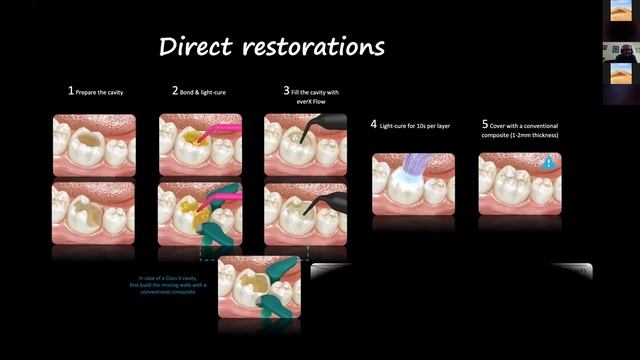 Prof. dr. Božidar Pavelić: Fiber-reinforced composites: basic theory and clinical procedures смотреть онлайн