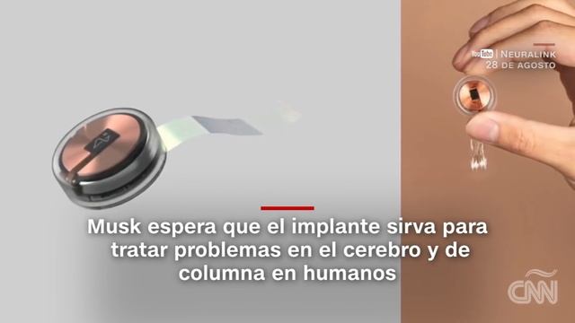 Elon Musk muestra cómo funciona el implante cerebral Neuralink usando un cerdo смотреть онлайн