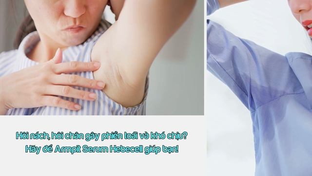 Hôi nách, hôi chân làm gì hết Mẹo chữa hôi nách, hôi chân hiệu quả tại nhà không dùng thuốc смотреть онлайн