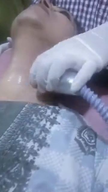 Hifu Laser Therapy Procedure Stemcell Aesthetic смотреть онлайн