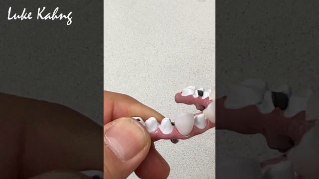 How to Make the Absolute Best Full-Mouth Restoration Option for Patients смотреть онлайн