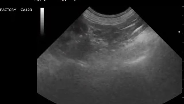 2 Левый норма смотреть онлайн