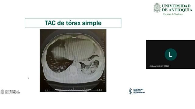 Clearing the Smoke: Enfoque o Dispersión de Distractores - Dr. Crhistian Gómez смотреть онлайн