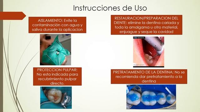 VITRE BOND PLUS TUTORIAL смотреть онлайн