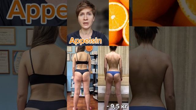 криолиполиз