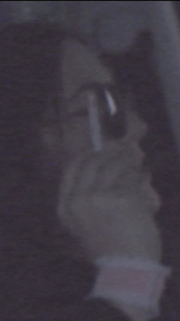 Esther/Leena Orphan First Kill edit #esther #orphan #orphan2009 #orphanfirstkill #materialgirl смотреть онлайн