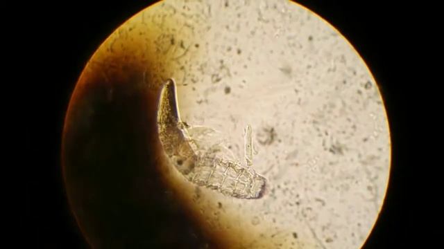 DEMODEX CANIS смотреть онлайн