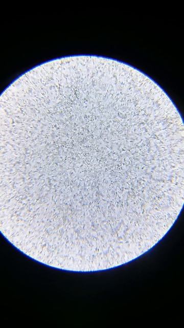 Семя пьетрен макстер