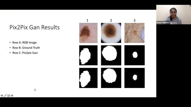Skin Cancer Detection using AI (Sreya Muppalla & Shreyaan Pathak, Data Scientist(Intern) Microsoft) смотреть онлайн