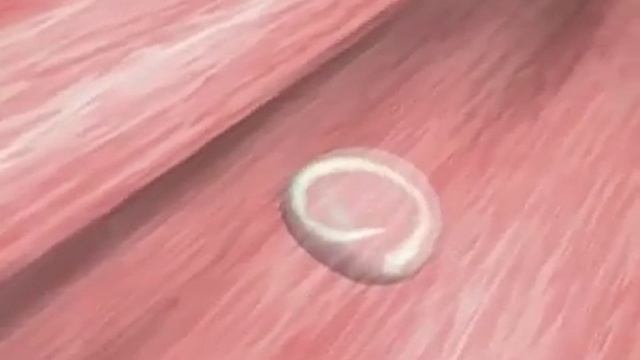 Canine Hookworms смотреть онлайн